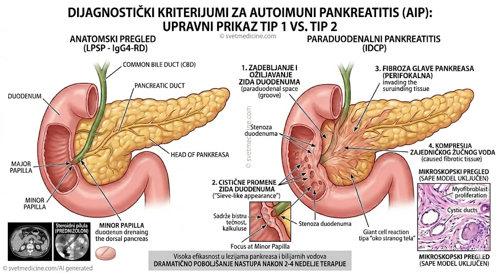 Dijagnostički kriterijumi za autoimuni pankreatitis (AIP) Tip 1 i Tip 2: morfologija, serologija i odgovor na steroide.