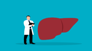 Faktori rizika za bolesti jetre: Kako na vreme prepoznati masnu jetru (MASLD/NAFLD)
